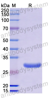 Recombinant Human IL20RB Protein, N-His