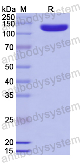 Recombinant Human CD109 Protein, N-His