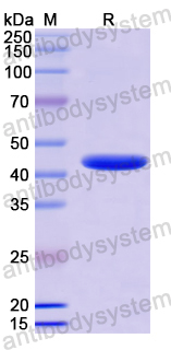 Recombinant Human SCARA5 Protein, N-His