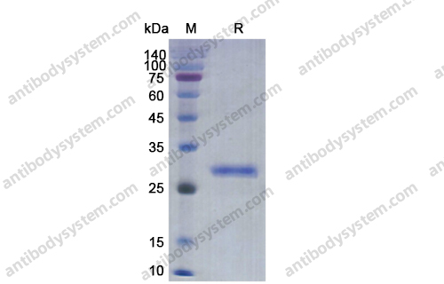 Recombinant Human IL34 Protein, N-His