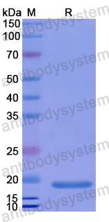 Recombinant Human AATK Protein, N-His
