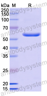 Recombinant Human MACC1 Protein, N-GST