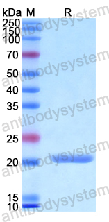 Recombinant Human HJV Protein, N-His