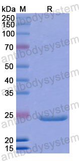 Recombinant Human CHSY3 Protein, N-His