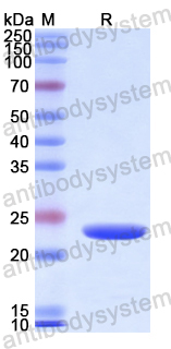 Recombinant Human IKBIP Protein, N-His