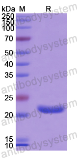 Recombinant Human CCDC80 Protein, N-His