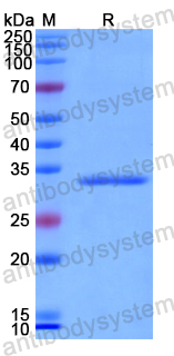 Recombinant Human SND1 Protein, N-His
