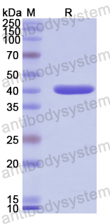 Recombinant Human DOK3 Protein, N-GST