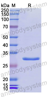 Recombinant Human MAEA Protein, N-His