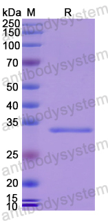 Recombinant Human ARC Protein, N-His