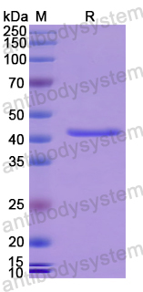 Recombinant Human RRM2B Protein, N-His