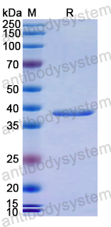 Recombinant Human MAVS Protein, N-His