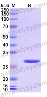 Recombinant Human CNTRL Protein, N-His