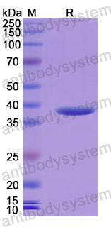 Recombinant Human S100A7A Protein, N-GST