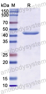 Recombinant Human AMIGO2 Protein, N-His