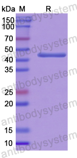 Recombinant Human MYPN Protein, N-His