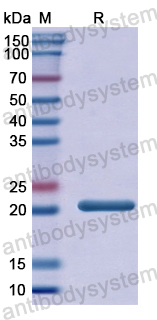 Recombinant Human DPP9 Protein, N-His