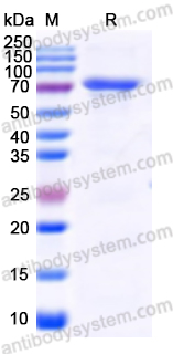 Recombinant Human METTL3 Protein, N-His