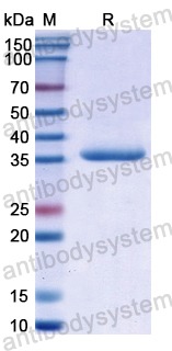 Recombinant Human LDB1 Protein, N-His