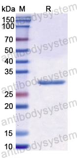 Recombinant Human KTN1 Protein, N-His