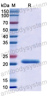 Recombinant Human ZFHX4 Protein, N-His