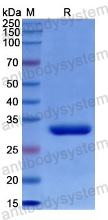 Recombinant Human ITIH5 Protein, N-His