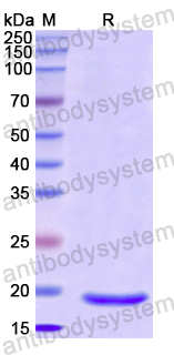 Recombinant Human ADIPOR2 Protein, N-His