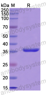 Recombinant Human PIM3 Protein, N-His