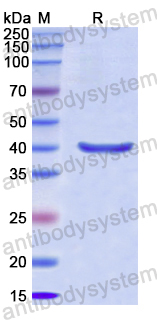 Recombinant Human CD163 Protein, N-His