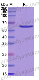 Recombinant Human PARG Protein, N-His