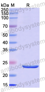 Recombinant Human IFNE Protein, N-His