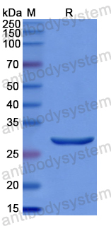 Recombinant Human STING1/TMEM173 Protein, N-His