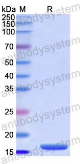 Recombinant Human DGKH Protein, N-His