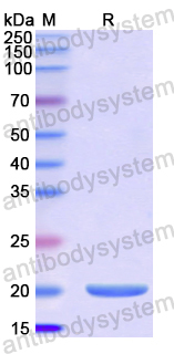 Recombinant Human GKN2 Protein, N-His