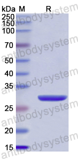 Recombinant Human ANGPTL5 Protein, N-His
