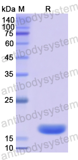 Recombinant Human XYLT1 Protein, N-His