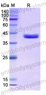 Recombinant Human HOMER1 Protein, N-His