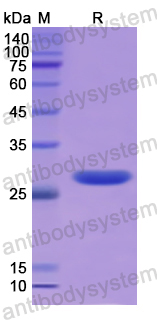 Recombinant Human MIB1 Protein, N-His