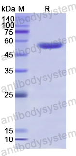 Recombinant Human KLB Protein, N-His