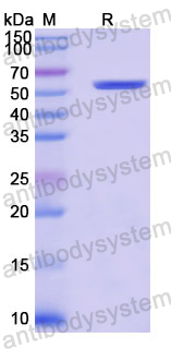 Recombinant Human KLB/Beta-klotho Protein, N-His