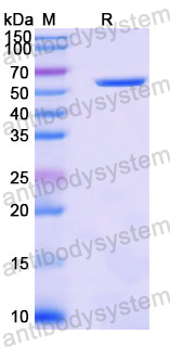 Recombinant Human KLB/Beta-klotho Protein, N-His