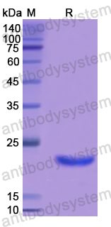 Recombinant Human IL29/IFNL1 Protein, N-His