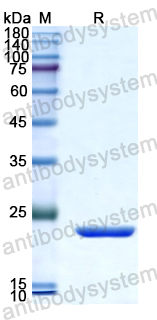 Recombinant Human NOSTRIN Protein, N-His