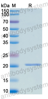 Recombinant Human IL28B/IL28C/IFNL3 Protein, N-His