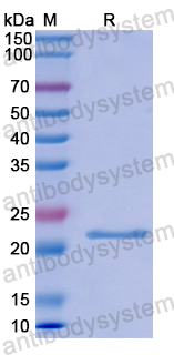 Recombinant Human IL28A/IFNL2 Protein, N-His