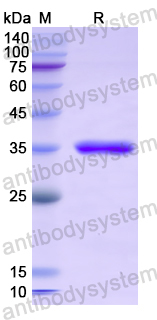 Recombinant Human LGI3 Protein, N-His