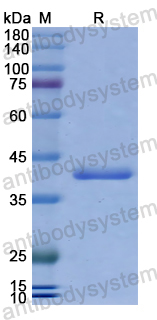 Recombinant Human AHI1 Protein, N-His
