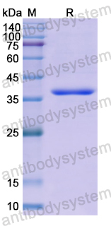 Recombinant Human DOCK4 Protein, N-His