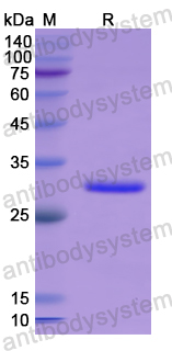 Recombinant Human PLCD3 Protein, N-His