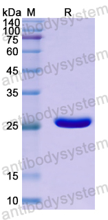 Recombinant Human FGFRL1 Protein, N-His